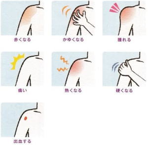 五十嵐内科 仙台市宮城野区福室 内科 呼吸器 循環器 土曜ＰＭ診療 喘息 高血圧症 糖尿病 脂質異常症 痛風 生活習慣病 肥満 ダイエット外来 睡眠時無呼吸症候群 発熱外来 健康診断 仙台市民健診 禁煙外来 ゾレアによる治療